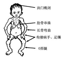 《0-3 岁婴幼儿的保育与教育》第五章 第三节 7~12月龄婴儿的疾病与意外伤害预防