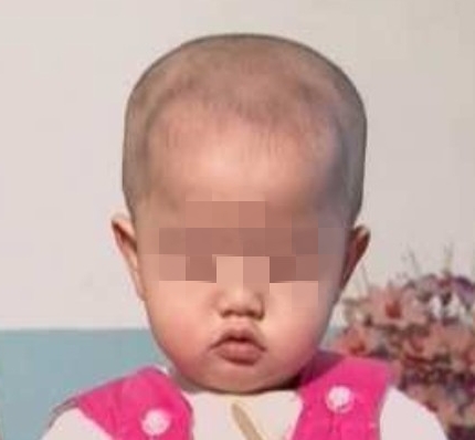 《0-3 岁婴幼儿的保育与教育》第五章 第二节 7~12月龄婴儿的疾病与意外伤害预防