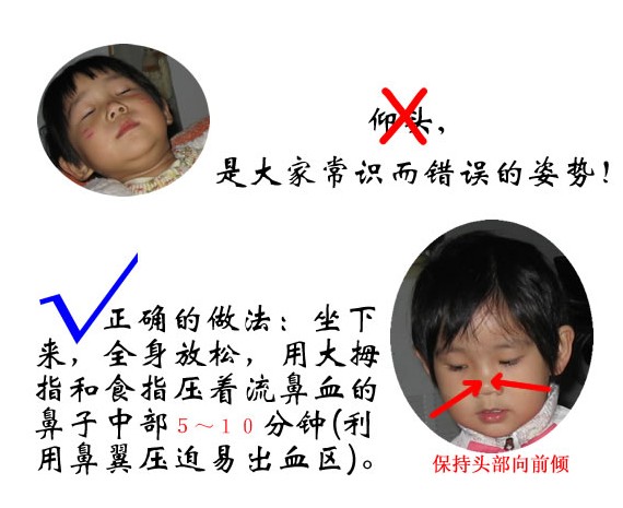 《0-3 岁婴幼儿的保育与教育》第六章 第三节 13~24月龄幼儿的疾病与意外伤害预防